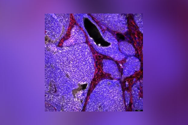 Cáncer-mama-ratón